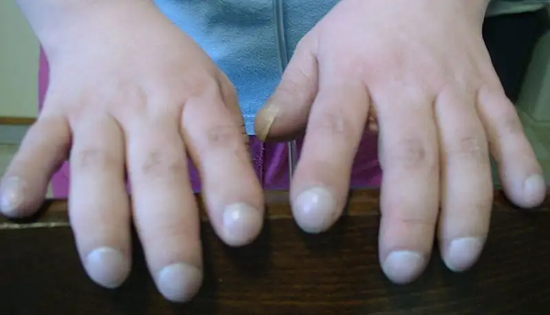 fat-fingers.webp