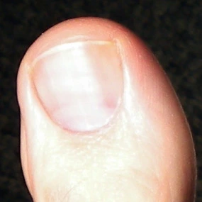 MyLeftBigToe2.webp