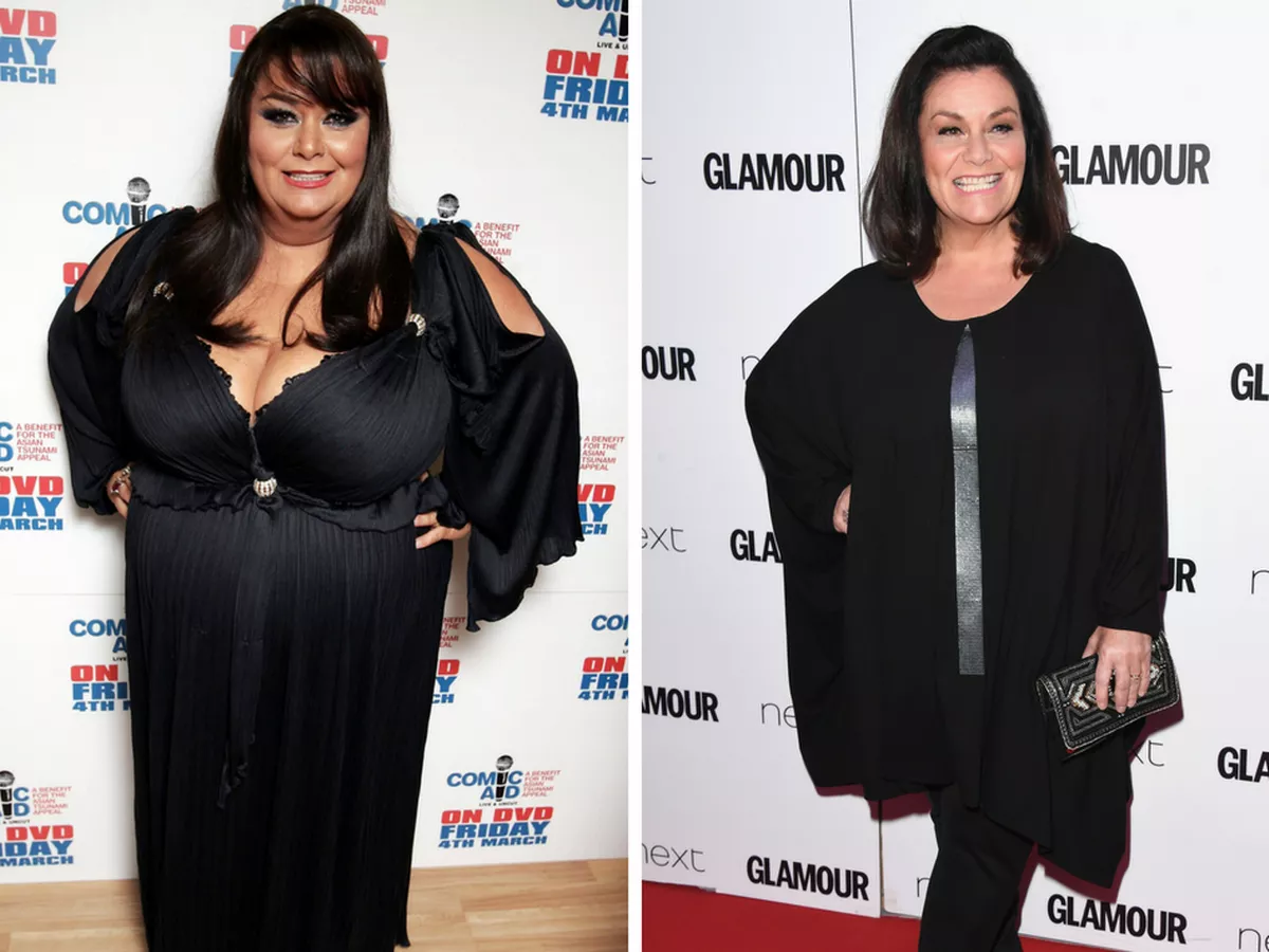 Dawn-French-Before-and-after.png